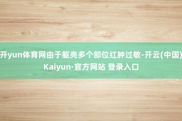 开yun体育网由于躯壳多个部位红肿过敏-开云(中国)Kaiyun·官方网站 登录入口