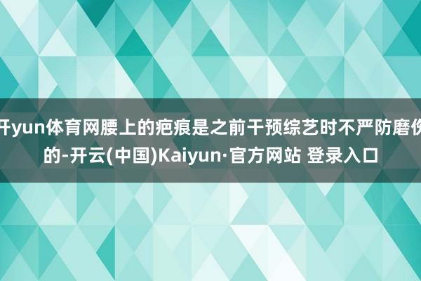 开yun体育网腰上的疤痕是之前干预综艺时不严防磨伤的-开云(中国)Kaiyun·官方网站 登录入口
